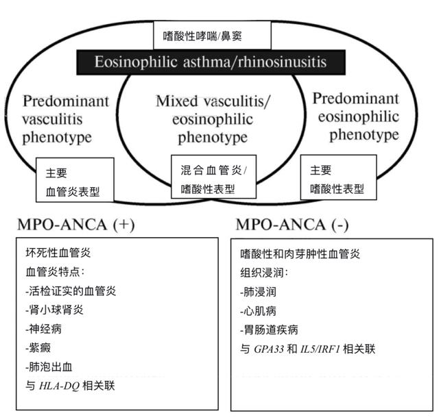 嗜酸性肉芽肿性多血管炎的ANCA检测的国际共识