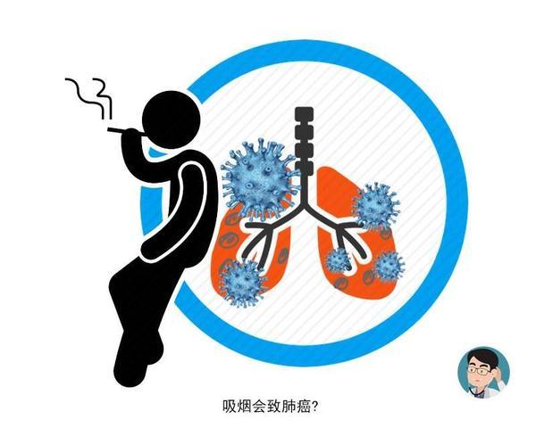 肩痛可能是肺癌信号？4类肺癌高危人群，希望你不在队列