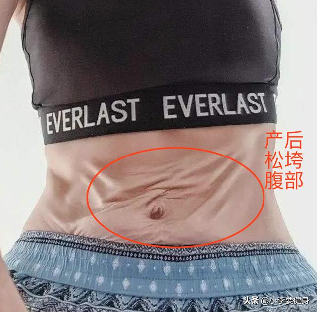 「超级宝妈」生完宝宝后，如何紧致松垮的腹部？4个简单动作，助你重拾马甲线