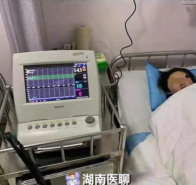 [超级宝妈]无痛分娩来啦！这样生孩子真的不痛吗？一位亲身经历的妈妈告诉你