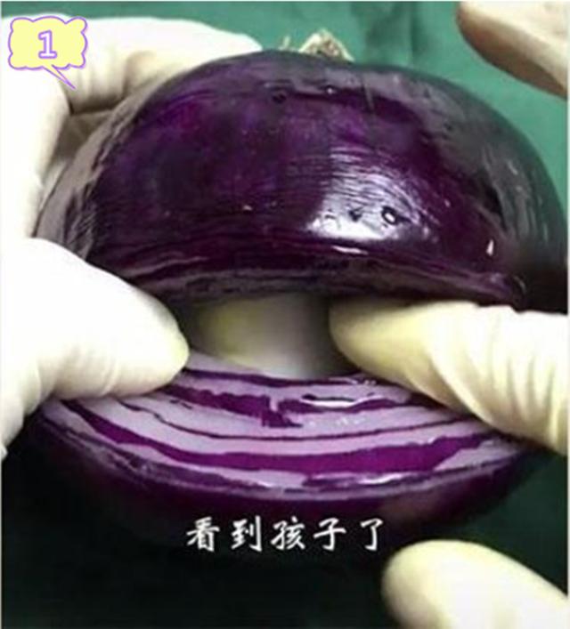 【你的育儿经】网友用洋葱模拟生娃全过程，过来人：看着就疼，你准备好了吗