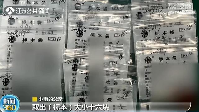 小雨|12岁女孩长“喉结”一查竟是甲状腺癌