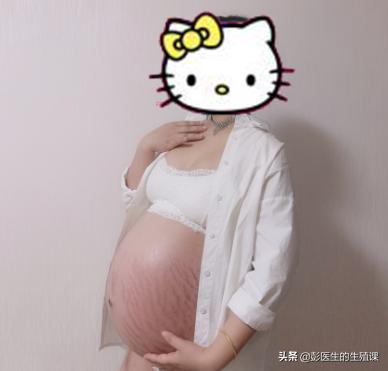 「你的育儿经」只有我以为做了试管就能成功怀孕，花了几十万就应该一次成功吗？