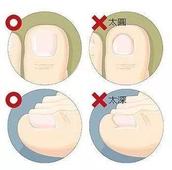 超级宝妈■孩子脸经常被划伤？宝宝剪指甲的正确方式，你知道吗？