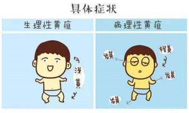 超级宝妈:生理性,还是病理性,面对新生儿黄疸宝妈该咋办