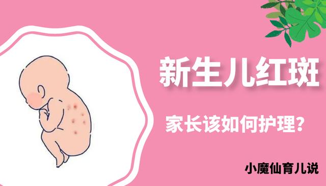 「你的育儿经」新生儿红斑 父母要怎么办？