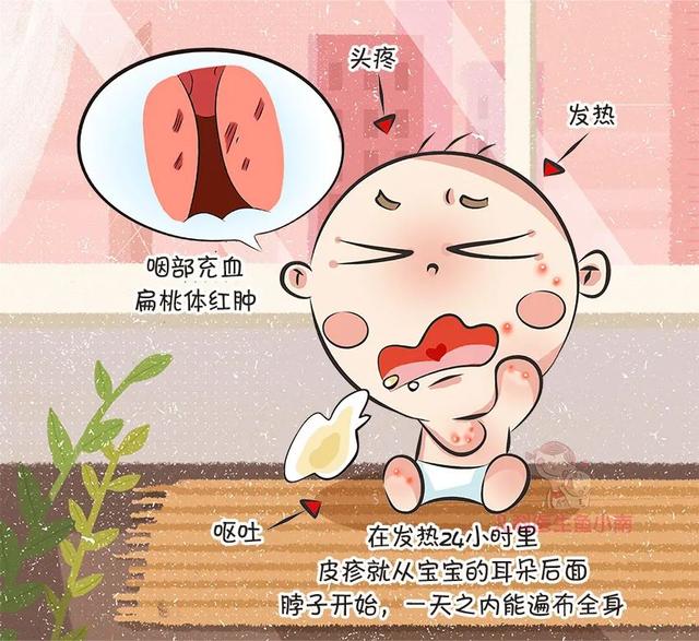 『你的育儿经』过敏、手足口、水痘,哪个不是省心的主,当前这些疾病必须要注意