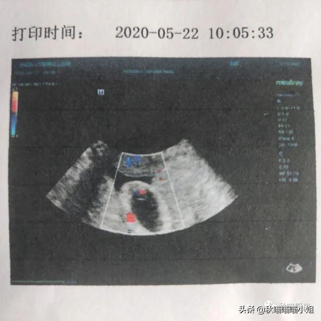 超级宝妈▲宝宝的第一张照片