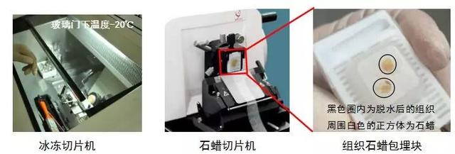 对付卵巢癌，这两个“利器”缺一不可