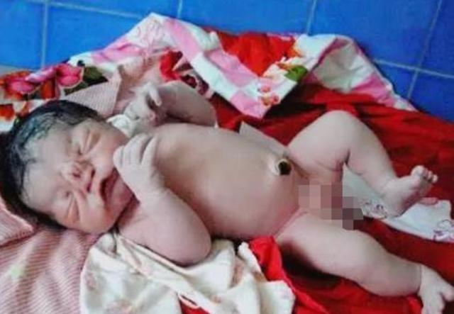爱上你的微笑|90后产妇足月分娩，竟然生下一个“猪八戒”？全家都乱成一团