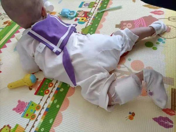 女士|推拿馆做艾灸治疗感冒，银川半岁女婴两条小腿深二度烫伤……