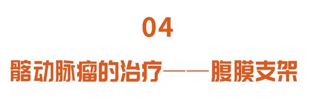血管|下腹有硬块别忽视，小心引发大出血，死亡率50%！三招早发现