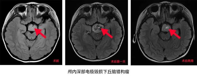 3岁女童性格好爱笑，但她的“微笑”却让父母操碎了心