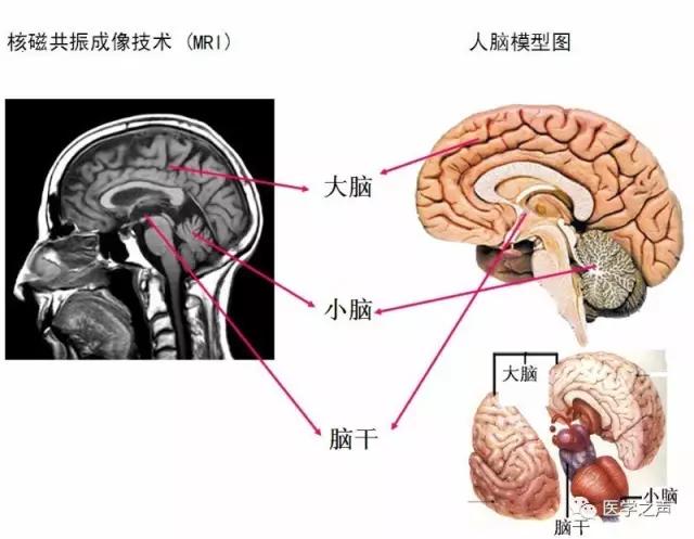 WoW，最全神经系统解剖图来了