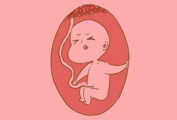 得不到糖的小孩|干货：准妈妈最容易混淆的10个分娩问题