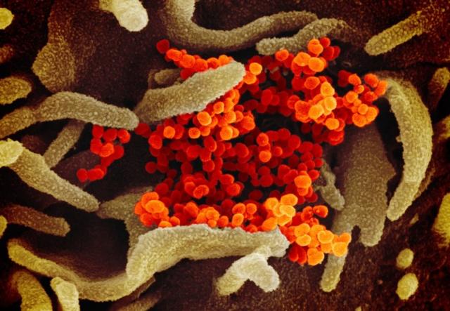 健康学堂：新冠病毒能在表面和空气中存活多长时间？新研究给出答案