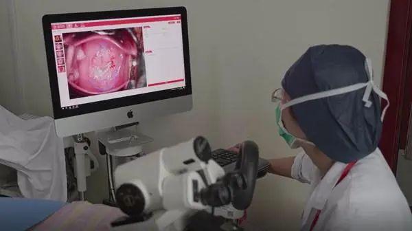 检查|宫颈癌筛查装上AI“眼睛”，医生效率提升十几倍