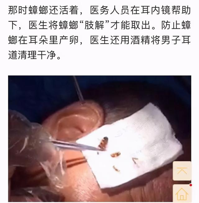 男子整整3天没法睡觉！去医院一查吓懵：耳朵里竟有只活蟑螂