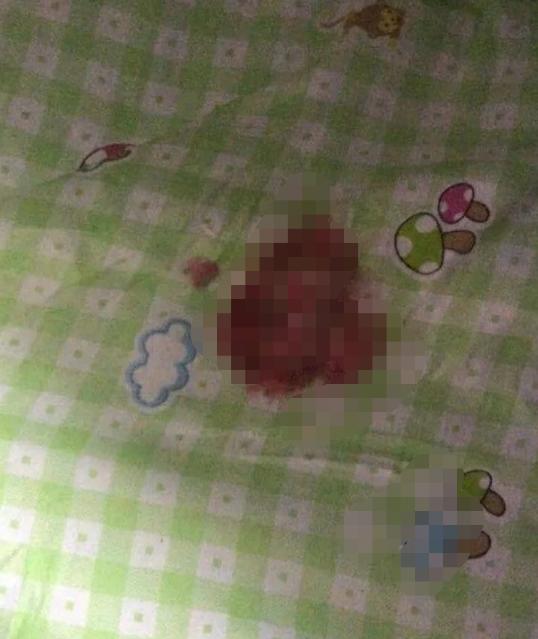 你的育儿经■三个月婴儿因＂趴睡＂窒息身亡，妈妈为何无动于衷