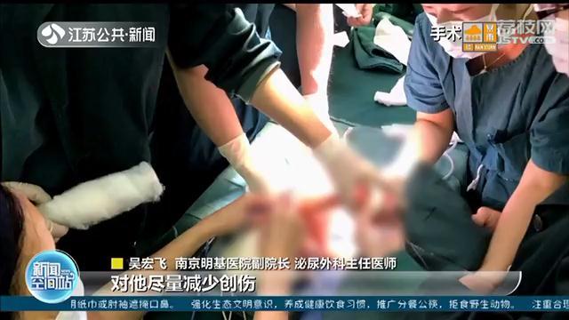 超级宝妈|左肾是正常婴儿十倍!出生三天的宝宝肾积水接受微创手术