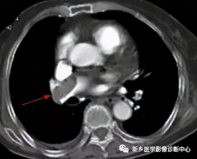 夜间值班腹部疼痛原因影像表现，值得收藏