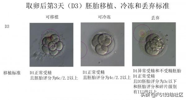 生活矜持点|试管婴儿胚胎评分和胚胎移植、冷冻、丢弃标准