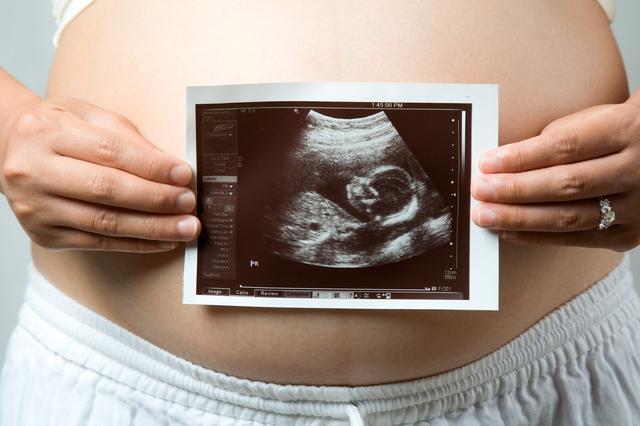 超级宝妈|弓形虫很可怕吗？掌握这些方法孕期一样可以养猫咪