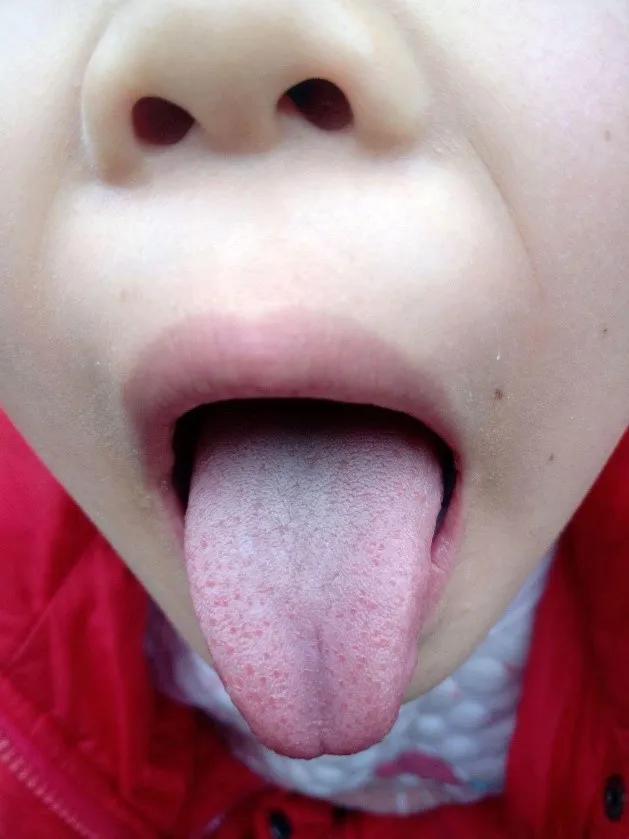 #你的育儿经#孩子生病时,需要先搞清楚寒热,减少帮倒忙