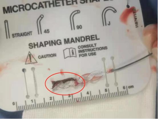 老李|“头晕”别大意，背后的健康杀手有可能是脑梗死