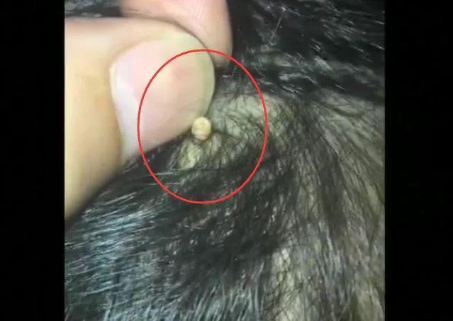 超级宝妈@这种常看到却总忽视的东西，会导致孩子脱发，宝妈们看自己娃有没