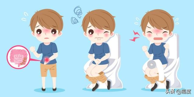 结直肠癌基础知识（一）