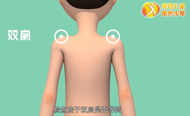 健康学堂|孩子高低肩，可能是病，这些脊柱侧凸自查方法，家长们一定要收藏