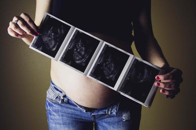 「你的育儿经」整个孕期做几次B超检查、分别多少周做？这有一份攻略，孕妈收藏