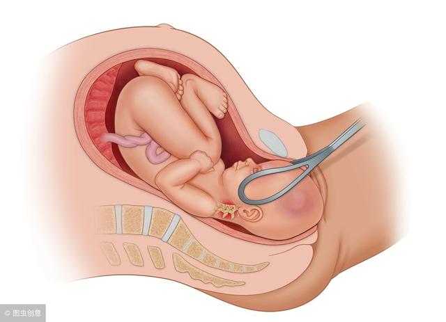 缩宫素|分娩之路不顺畅，助产手段知多少