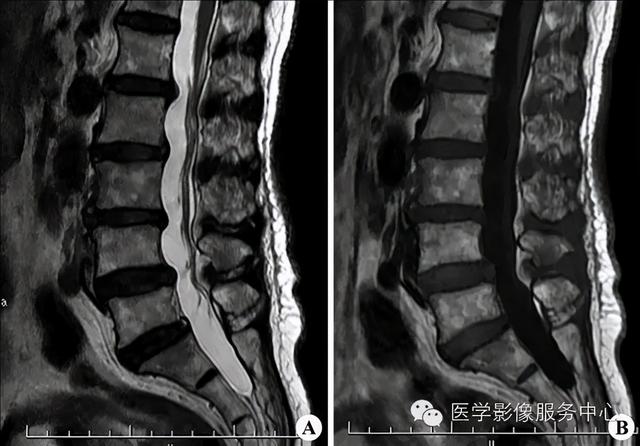 77种骨肌影像病例，助你诊断无忧