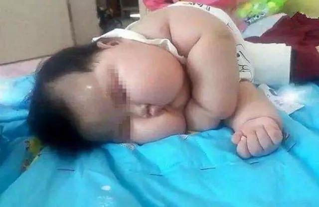 「超级宝妈」6个月宝宝胖成“米其林”，父母拍照炫耀，网友：带娃去医院吧