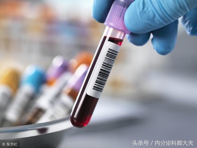 空腹来抽血，你做对了吗？