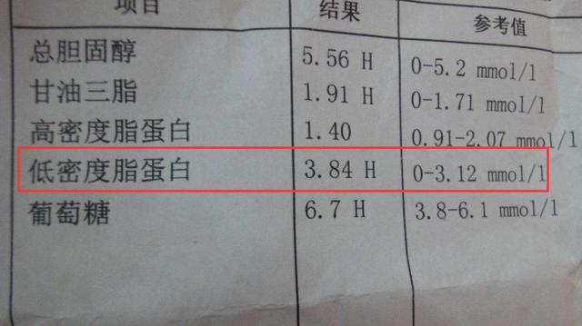 50岁以上，体检中1个血液指标要重视，当心大意招来脑梗