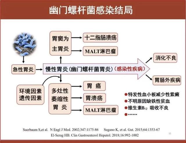 幽门螺杆菌是怎样损伤胃的？| 主任谈消化