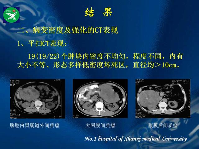 李健丁教授：胃肠道外间质瘤的CT表现和临床病理分析