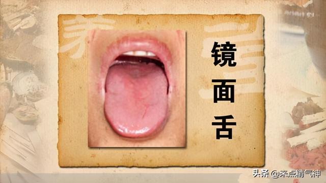 舌苔的颜色、多少和薄厚是辨别健康“指标”