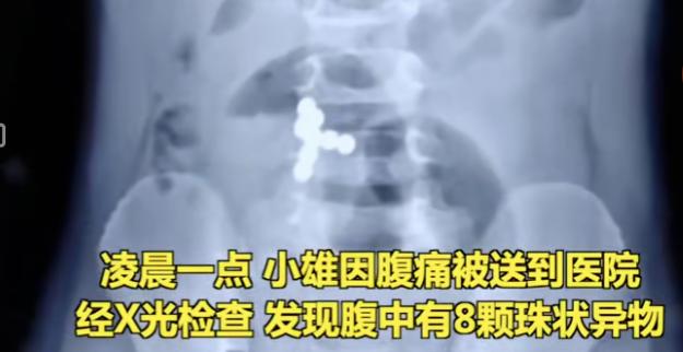 儿童|男童误吞8颗磁力珠导致肠穿孔！市场监管总局最新提示：慎买这3类儿童产品
