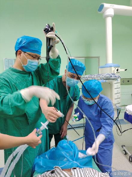 咳嗽|鱼骨头卡在肺里12年后被取出