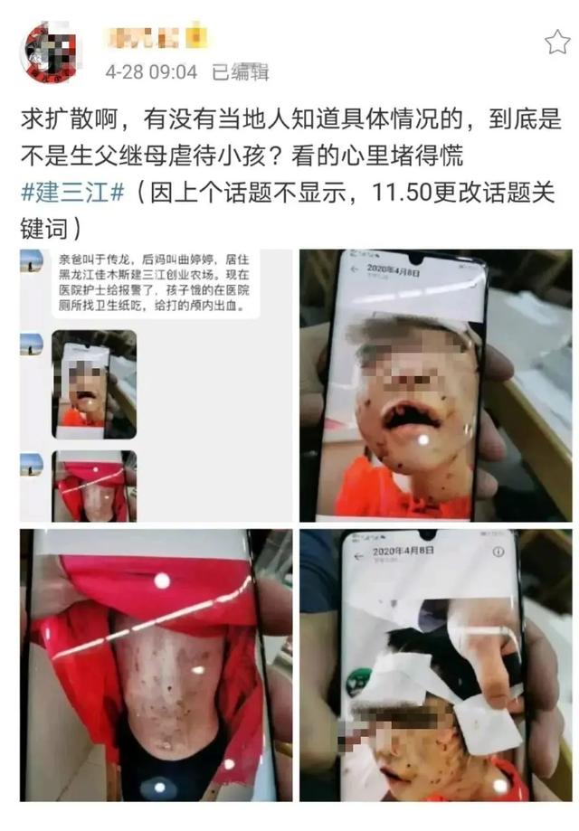 优雅的叶子■4岁女童被“网红”后妈虐待濒死：有些人，真的不配当父母