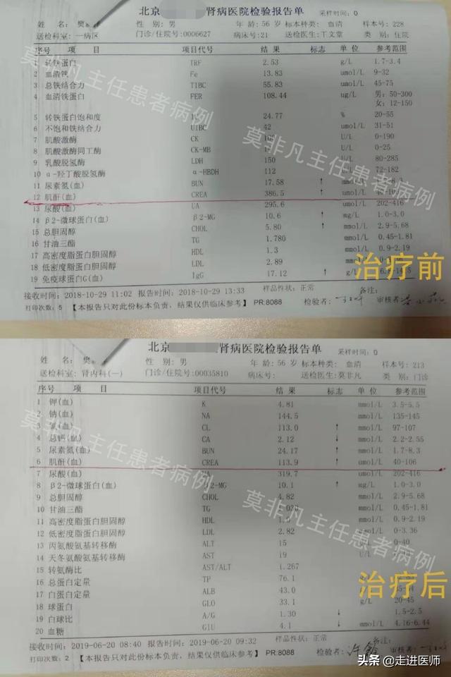 肌酐升高时，人体会出现哪些症状？肌酐386中医治疗降为正常值