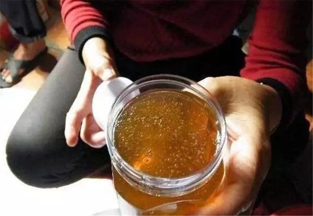 暖先生格调■3岁儿子误食纽扣电池，妈妈灌下蜂蜜，医生：很有常识！