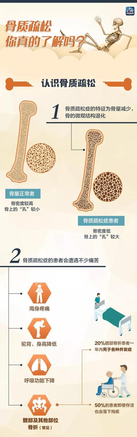 来源|晒太阳可以预防骨质疏松？医生：这是真的