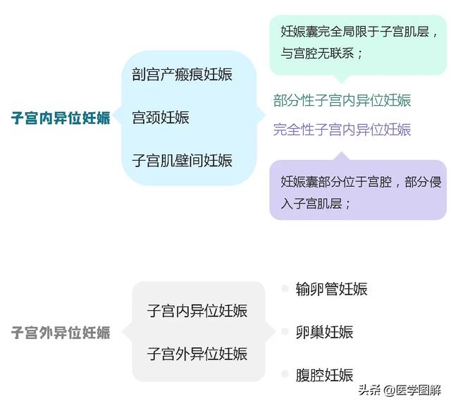 你的育儿经■ESHRE关于正常位置妊娠和异位妊娠术语的专家共识