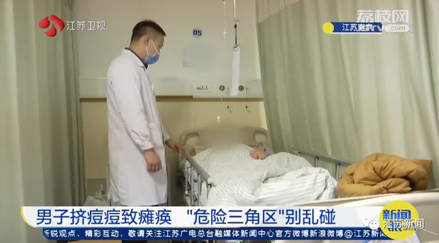 痘痘|警惕！挤了颗痘痘，瘫痪了