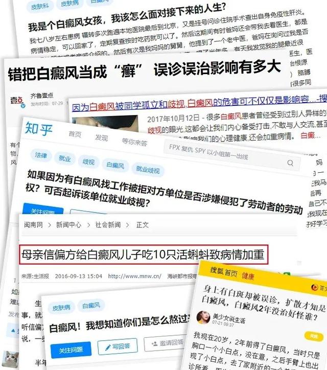 白癜风|正式通知！国家重点实验室在辽宁省招募100名白癜风患者，点击查看报名